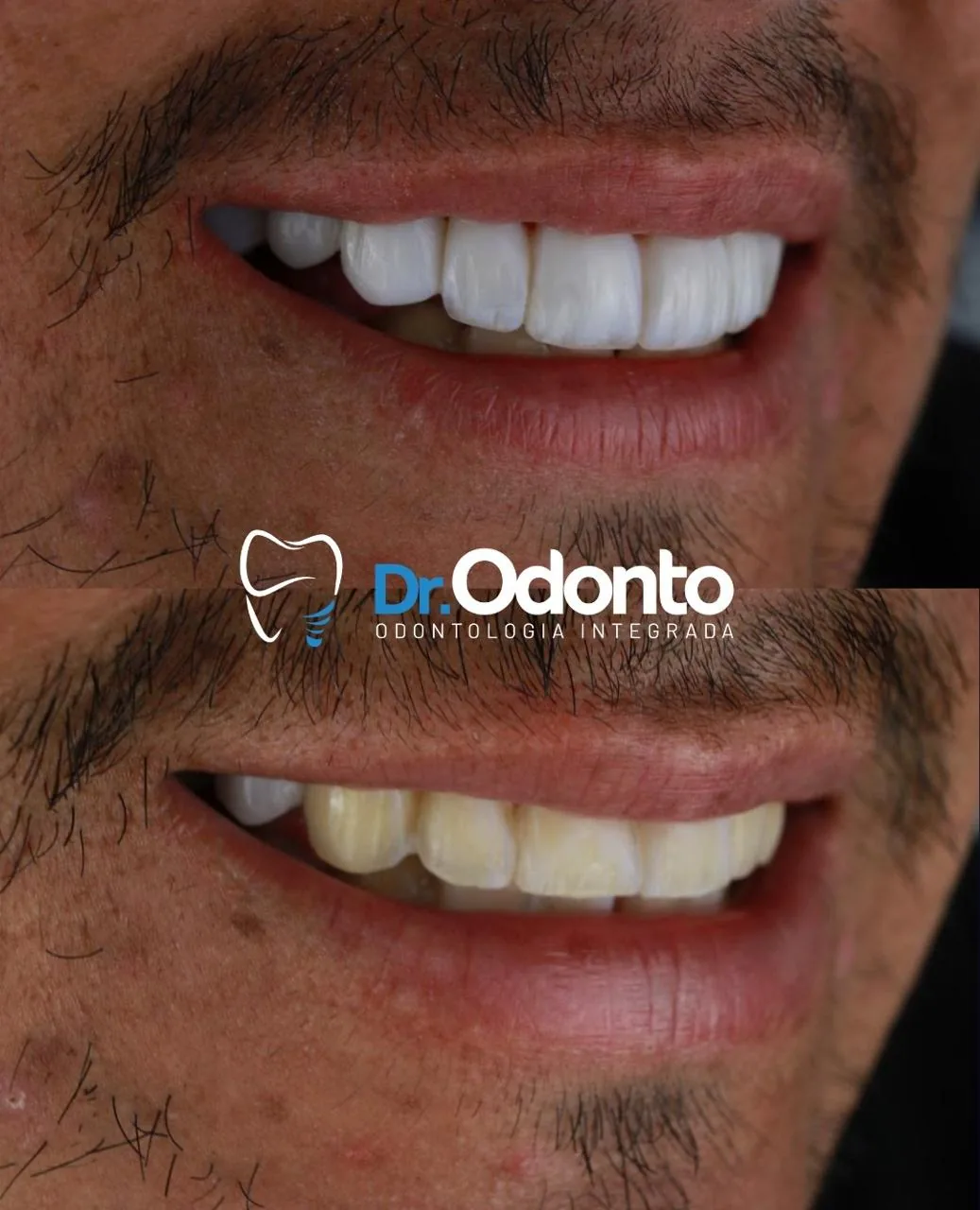 Dr. Leonardo Castelo Branco - Cirurgia Bucomaxilofacial